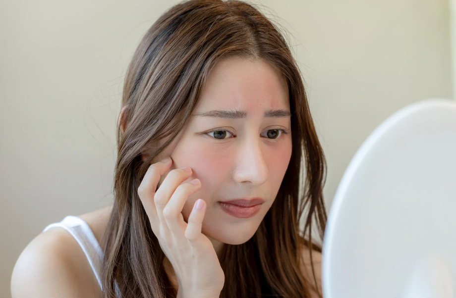 ステロイドでニキビ治療 | ニキビに与える影響や種類を詳しく解説
