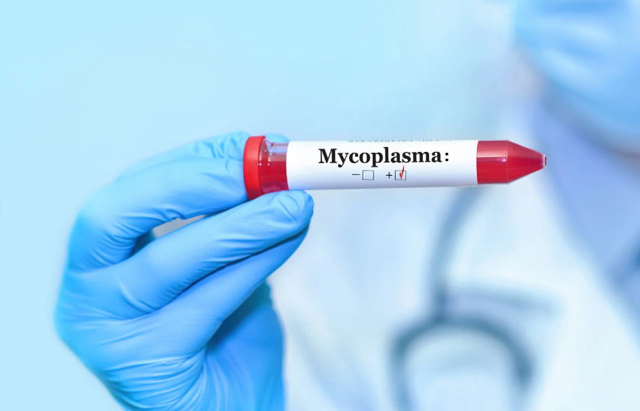 マイコプラズマ(性病)の原因 | 肺炎との違いや潜伏期間を解説
